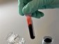 Проба крови в антидопинговой лаборатории. Фото (c)AFP
